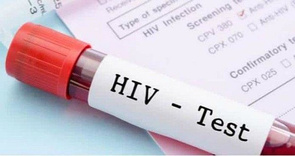 Examen VIH
